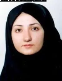 نوبت دهی دکتر زکیه یعقوبی فوق تخصص قرنیه