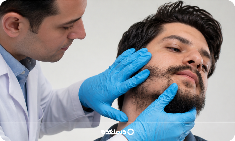 کاشت ریش و سبیل [۴ روش، عوارض، دوره نقاهت + بهترین سن]