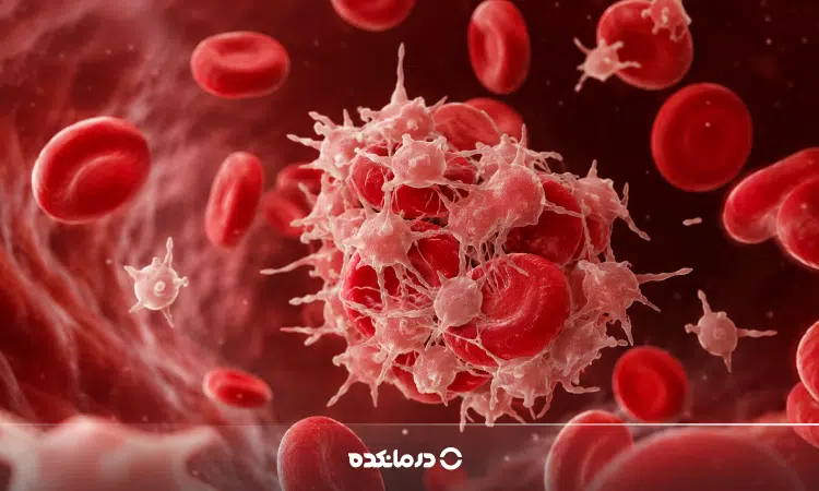 پایین بودن پلاکت خون نشانه سرطان است؟ بررسی رابطه پلاکت پایین با سرطان