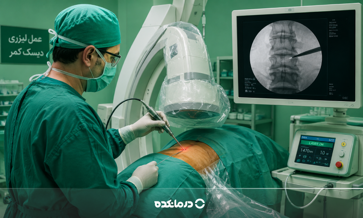 عمل لیزری دیسک کمر چیست؟ مزایا، عوارض و روش انجام جراحی دیسک با لیزر