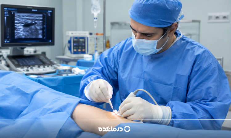 عمل واریس پا چگونه انجام میشود؟ بررسی انواع جراحی، عوارض و دوره نقاهت