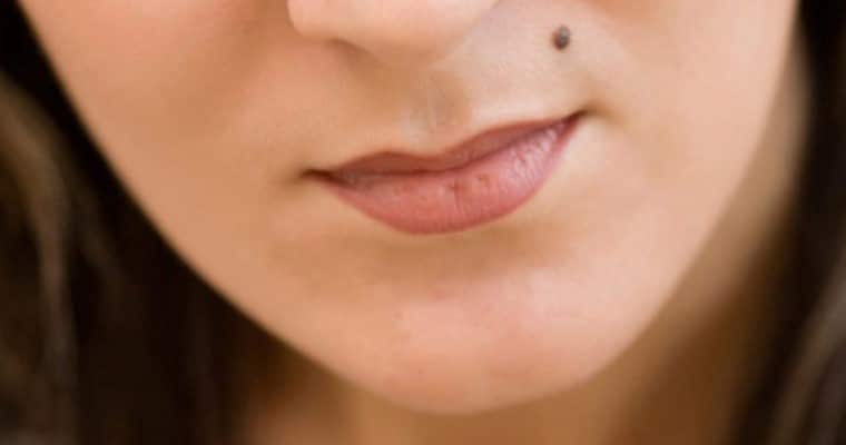 خالهای قرمز و سیاه روی صورت نشانه چه چیزی هستند؟