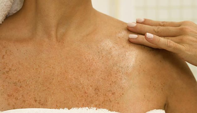 خالهای قرمز، سیاه و سبز روی بدن نشانه چه چیزهایی هستند