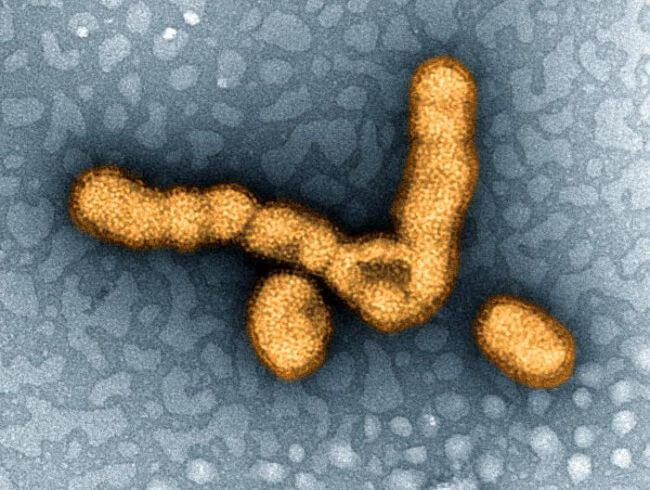 ویروس آنفولانزا