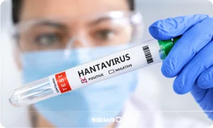 ویروس هانتا چیست و چطور به انسان منتقل میشود؟ آیا این بیماری کشنده است؟