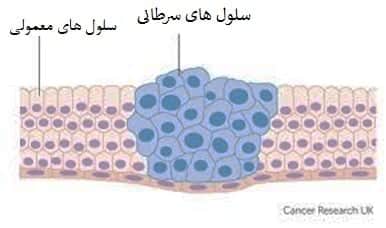 سلول های سرطانی