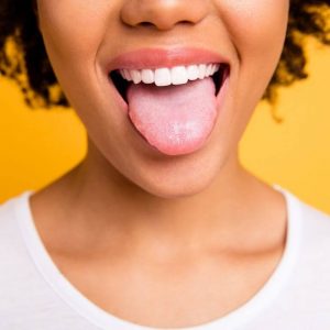 7 علت زرد شدن زبان و راه درمان آن