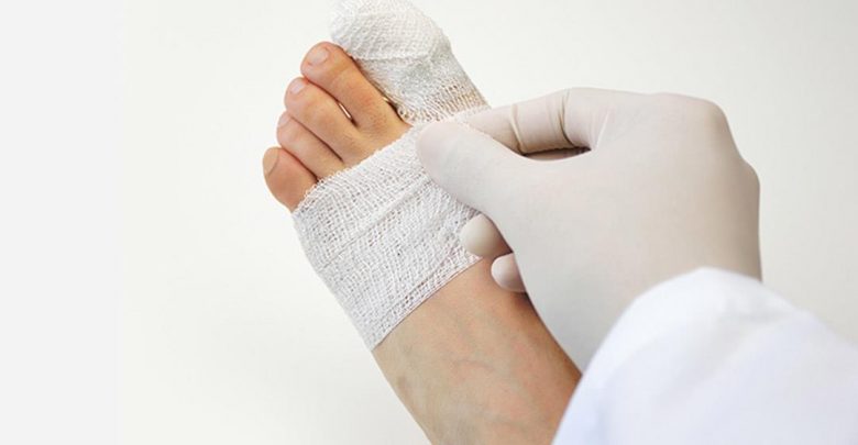 درد انگشت پا به علت شکستگی یا پیچ خوردگی؟