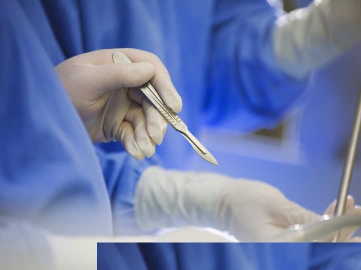 روش‌های عقیمسازی زنان و مردان از طزیق جراحی است که دائمی به حساب می‌آید.