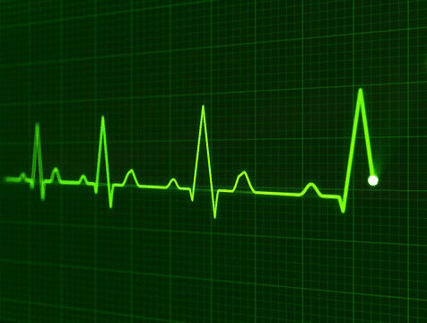 EKG به طور ساده‌ای فعالیت الکتریکی قلب شما را پایش می‌کند. الکتروکاردیوگرام هیچ الکتریسیته‌ای ساطع نمی‌کند و کاملاً ایمن است.