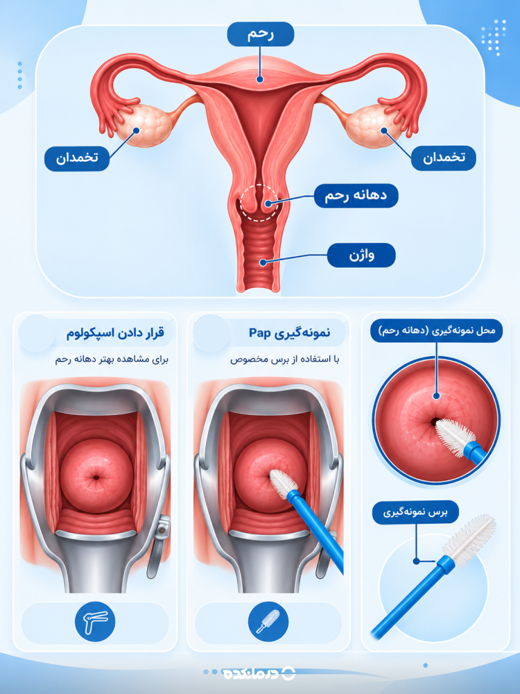 محل نمونهگیری در آزمایش پاپ اسمیر