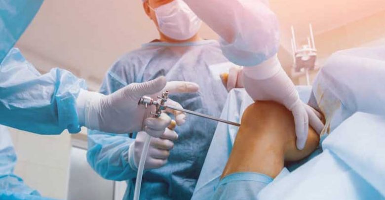عمل جراحی آرتروسکوپی چیست؟
