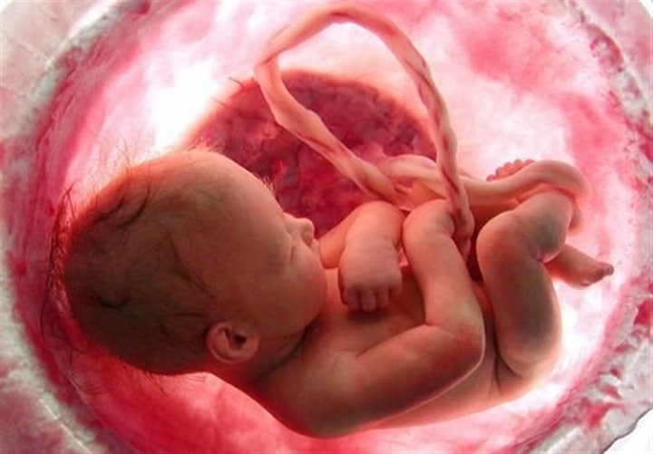 دلایل سقط جنین