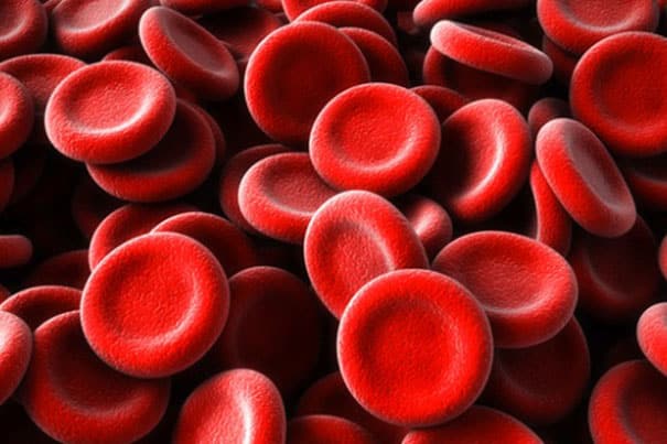 اگر تشخص داده شود که میزان گلبول قرمز در خون پایین است، پزشک ترکیبی از تغییر رژیم غذایی، مصرف روزانه‌ی مکمل آهن و دارو را پیشنهاد می‌کند تا میزان گلبول قرمز به حالت طبیعی برگردد.