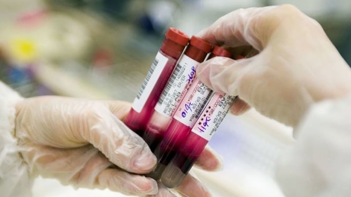 رایج‌ترین انواع تست خون برای شمارش گلبول‌های خون و بررسی وضعیت کلسترول و تیروئید کاربرد دارد. هرچند گاهی آزمایش خون برای بررسی بیماری‌های نادر هم کاربرد دارد.