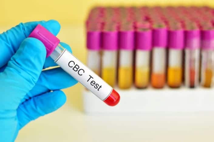 آزمایش CBC برای تشخیص کافی و قطعی نیست. افزایش یا کاهش تعداد گلبول خون می‌تواند ناشی از طیف گسترده‌ای از اختلالات باشد.