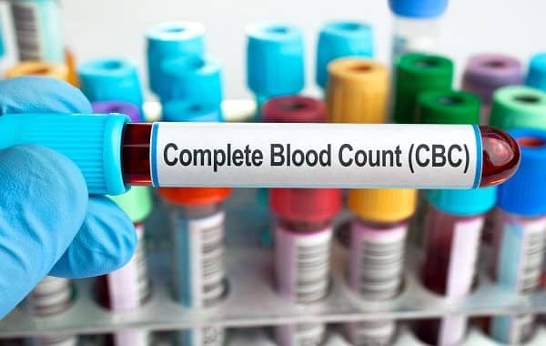 افزایش یا کاهش تعداد گلبول خون در این آزمایش خون (آزمایش CBC) مشخص می‌شود.