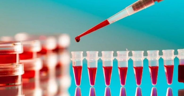 آزمایش CA-125 یا آنتی ژن سرطانی چیست؟
