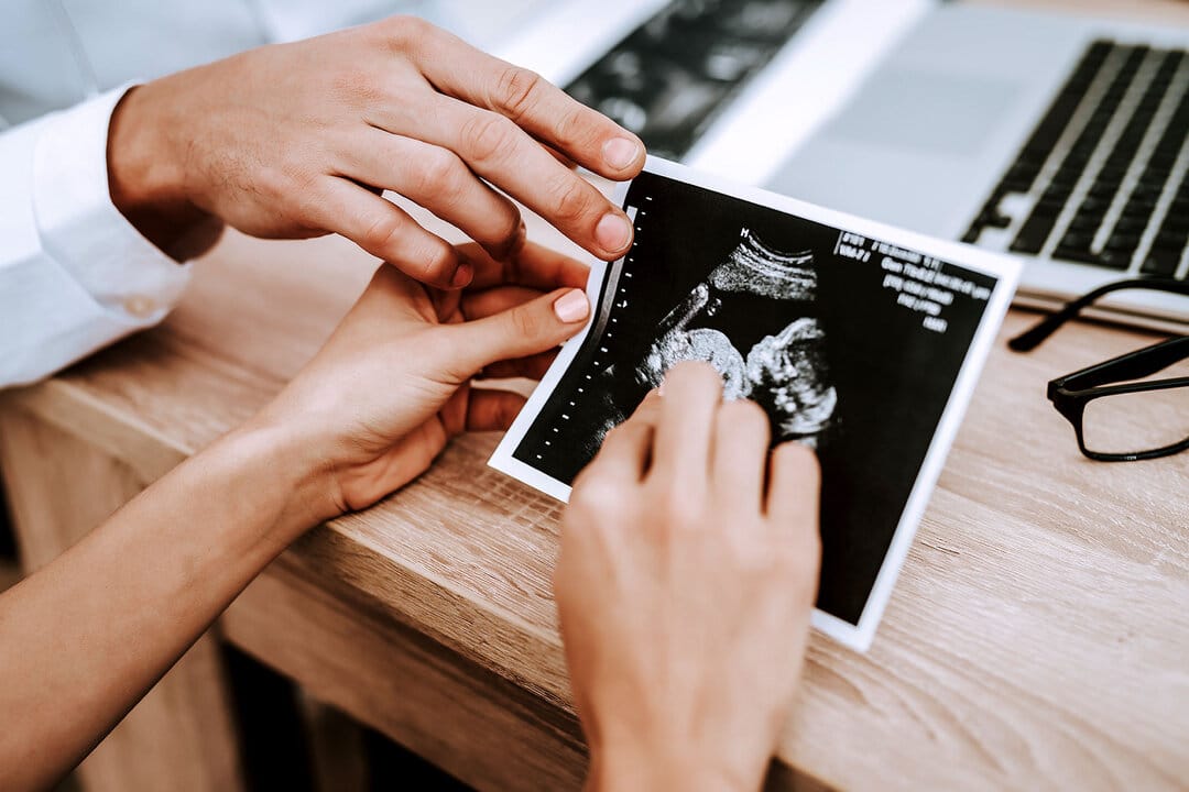 آگاهی از وضعیت جنین از اول بارداری تا زایمان اهمیت زیادی دارد که باید هر مرحله حاملگی را به خوبی بشناسید.