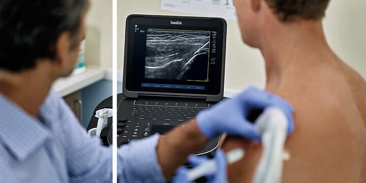 سونوگرافی ارتوپدی برای بافت‌ها و عضلات کاربرد دارد.