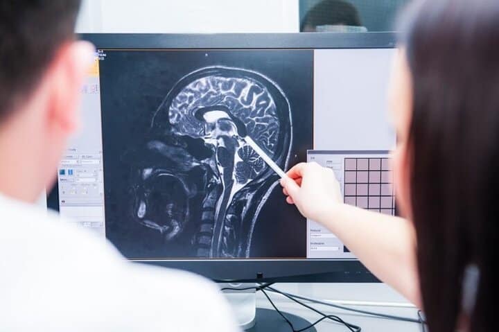  ام آر آی مغز عموما برای بررسی مغز، نخاع، چشم، گوش و سایر اعضای نواحی سر و گردن به کار می‌رود.