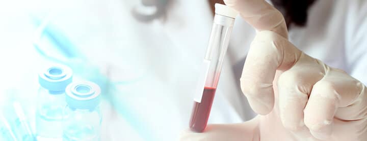پانل متابولیک پایه از طریق آزمایش خون اطلاعات مفیدی درمورد سلامت فرد به پزشک می‌دهد.