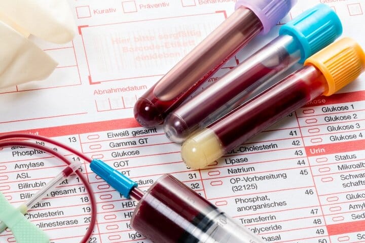 نتایج غیرعادی تست خون نشان دهنده بیماری‌های کلیوی، دیابت و بی‌نظمی هورمونی هستند.