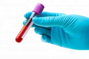 میانگین غلظت هموگلوبین گلبول‌های قرمز (MCHC) متوسط ​​غلظت هموگلوبین در گلبول‌های قرمز خون است.