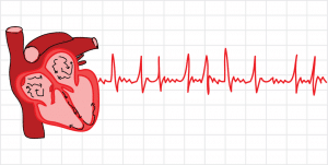 به غیرعادی بودن ضربان قلب آریتمی می‌گویند. اگر ضربان قلب نامنظم باشد، می‌گوییم آریتمی رخ داده است. تشخیص و درمان به موقع آریتمی به زندگی سالم کمک می‌کند.