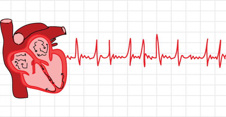انواع آزمایشاتی که به تشخیص آریتیمی قلب کمک می کنند.