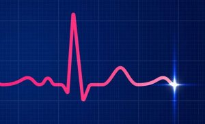 الکتروکاردیوگرام EKG یک آزمایش ساده و بدون درد است که فعالیت الکتریکی قلب شما را می‌سنجد.