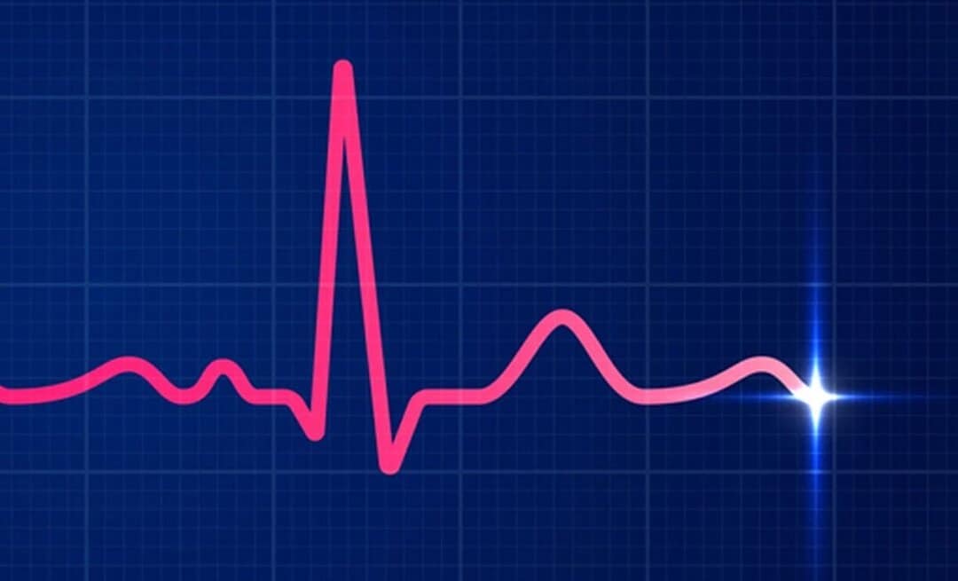 الکتروکاردیوگرام EKG یک آزمایش ساده و بدون درد است که فعالیت الکتریکی قلب شما را می‌سنجد.
