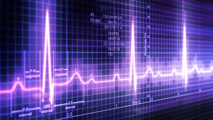 گرفتن EKG سریع، بدون درد و بی‌ضرر است. الکتروکاردیوگرام زمانی که تحت پایش هستید، تصویری از فعالیت الکتریکی قلب شما را ضبط می کند