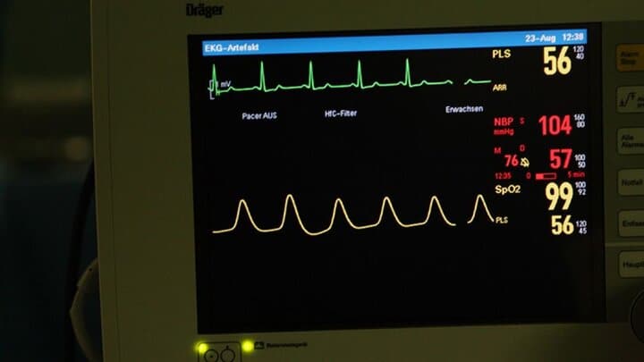 دستگاه الکتروکاردیوگرام EKG برق تولید نمی‌کند. در واقع، فعالیت الکتریکی را تولید و اندازه گیری می‌کند.