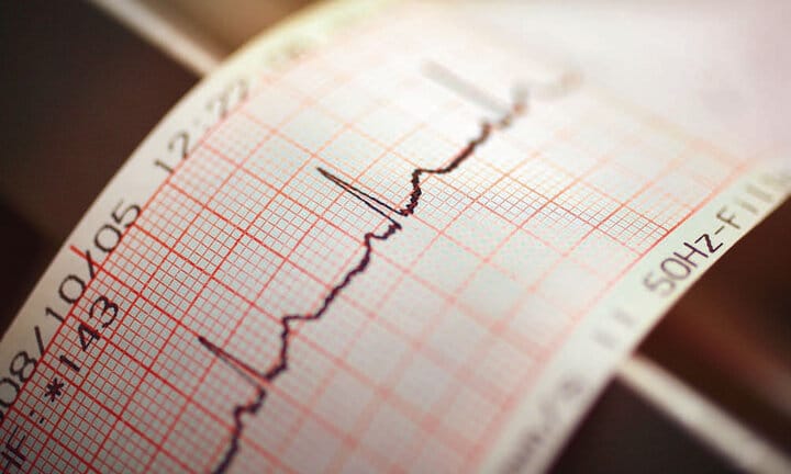 اگر فشار یا درد قفسه سینه احساس می‌کنید، احتمالا پزشک الکتروکاردیوگرام را برای بررسی عملکرد قلب شما انتخاب کند.