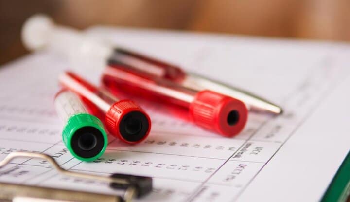 آزمایشات A1C میزان هموگلوبین موجود در خون که گلوکز به آن متصل است (قند خون) را مورد سنجش قرار می‌دهند.