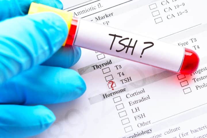 TSH یا هورمون محرک غده تیروئید، هورمونی است که تولید هورمون T3 و T4 را در غده تیروئید تحریک می‌کند.