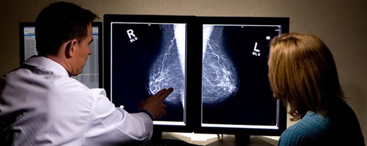 سرطان سینه، تنها دلیل وجود یک توده در سینه نیست. ماموگرافی می‌تواند نشان دهد دچار فیبروز یا کیست نیز شدید.
