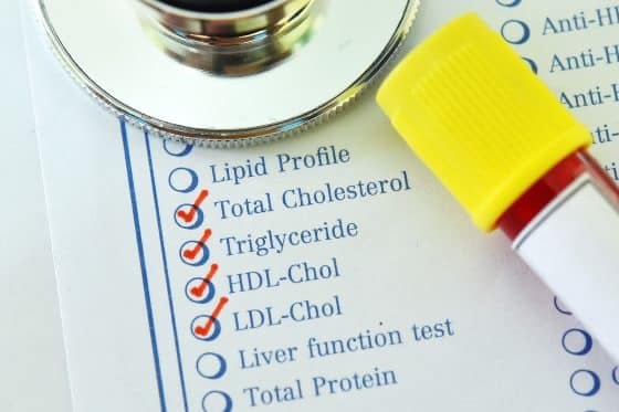 اگر مبتلا به دیابت هستید باید بیشتر تست LDL بدهید.
