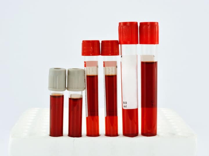 تست RBC تقریباً همیشه بخشی از یک آزمایش کامل شمارش خون (CBC) است. آزمایش CBC تعداد کلیه اجزای موجود در خون را اندازه‌گیری می‌کند