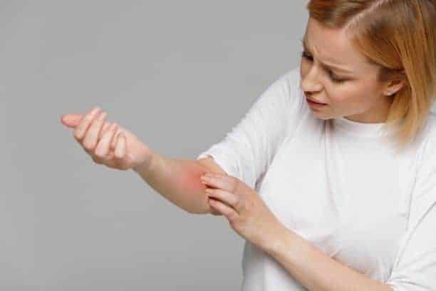 اگر آلرژی شدید دارید، متخصص حساسیت می‌تواند شرایط شما را ارزیابی کرده و به شما در مدیریت علائم کمک کند.