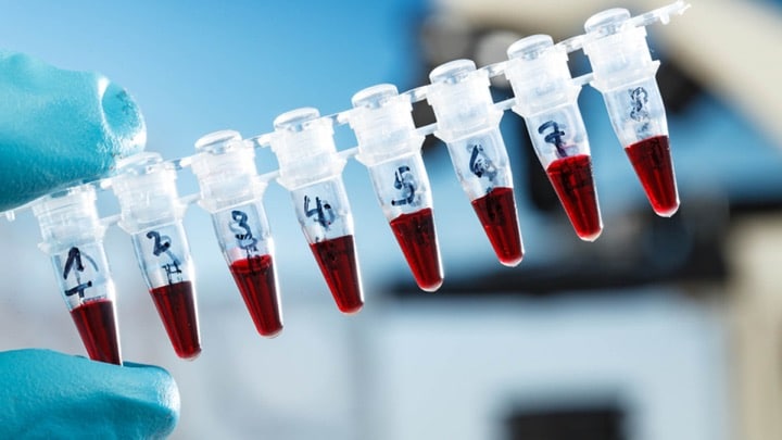 از نتایج آزمایشات RT-PCR، برای تصمیم‌گیری در خصوص قرار دادن تجهیزات حفاظتی در اختیار کادر درمان و یا برگشت آن‌ها به محل کار استفاده می‌شود.