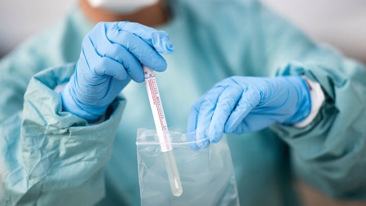 زمان گرفتن نمونه تست PCR برای کشت ویروس کرونا اهمیت دارد.