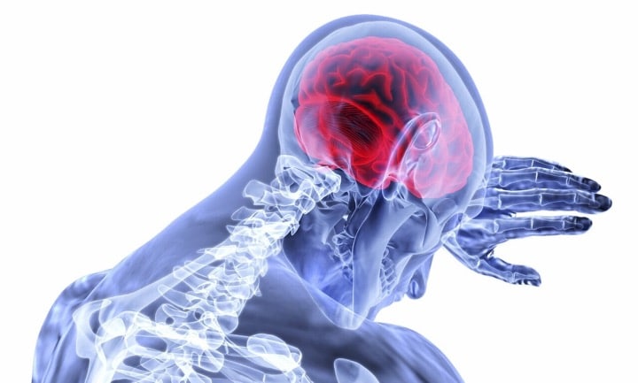سکته مغزی به دلیل ایجاد عواقب تهدید کننده حیات یک فوریت پزشکی است