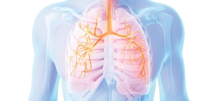 نارسایی دستگاه تنفسی می‌تواند حاد یا مزمن باشد.