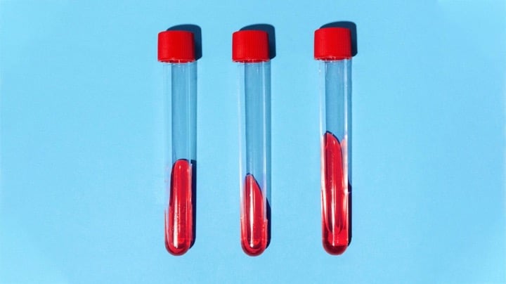 تست STI تنها روشی است که به صورت قطعی، وضعیت ابتلا به STI را مشخص میکند.