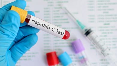هپاتیت C نوعی از تخریب کبد است که در اثر ویروس HCV (ویروس نوع C) بوجود می‌آید.