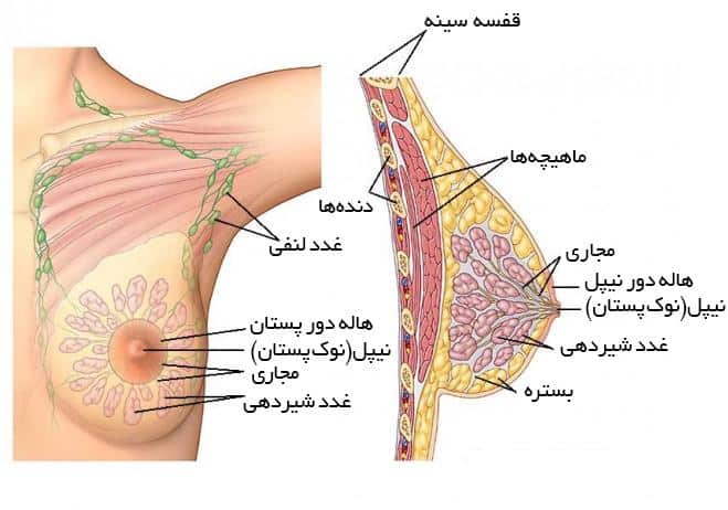 سرطان سینه