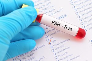 آزمایش FSH مقدار FSH موجود در خون شما را اندازه گیری می‌کند. هدف پزشک از انجام این آزمایش ارزیابی عملکرد هیپوفیز بیمار است