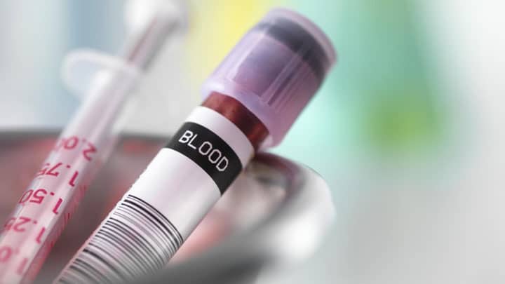 آزمایش خون CBC Diff